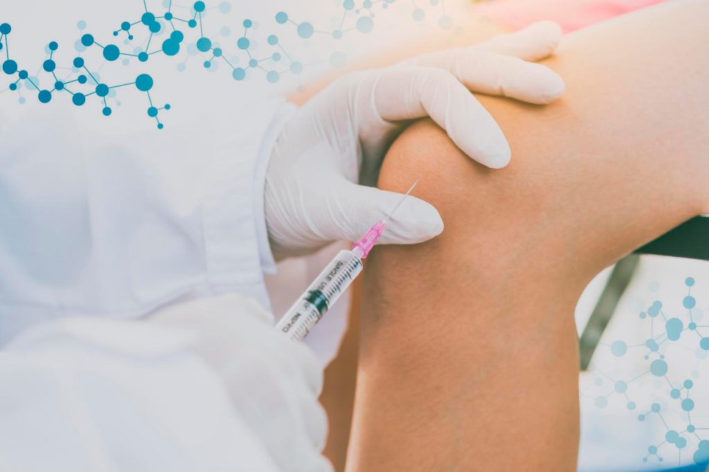 Stem Cell Therapy for Knees